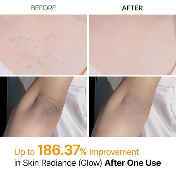 Radiant Skin Transformation Spray™